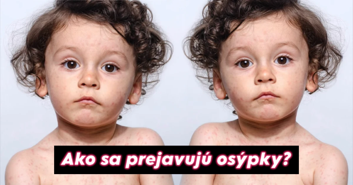 osýpky
